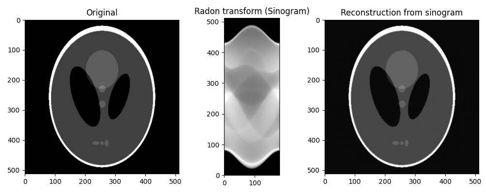 Original, Radon transform (Sinogram), Reconstruction from sinogram